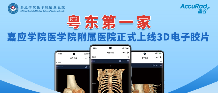“手機掃一掃，云端影像隨時(shí)看”！盈谷網(wǎng)絡(luò )助力嘉應學(xué)院醫學(xué)院附屬醫院3D電子膠片正式上線(xiàn)！