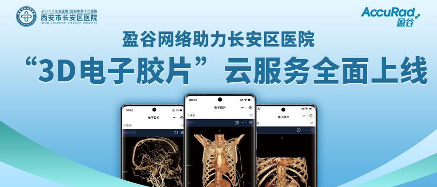 盈谷網(wǎng)絡(luò )助力長(cháng)安區醫院“3D電子膠片”云服務(wù)全面上線(xiàn)！診斷結果、影像資料隨時(shí)隨地看！